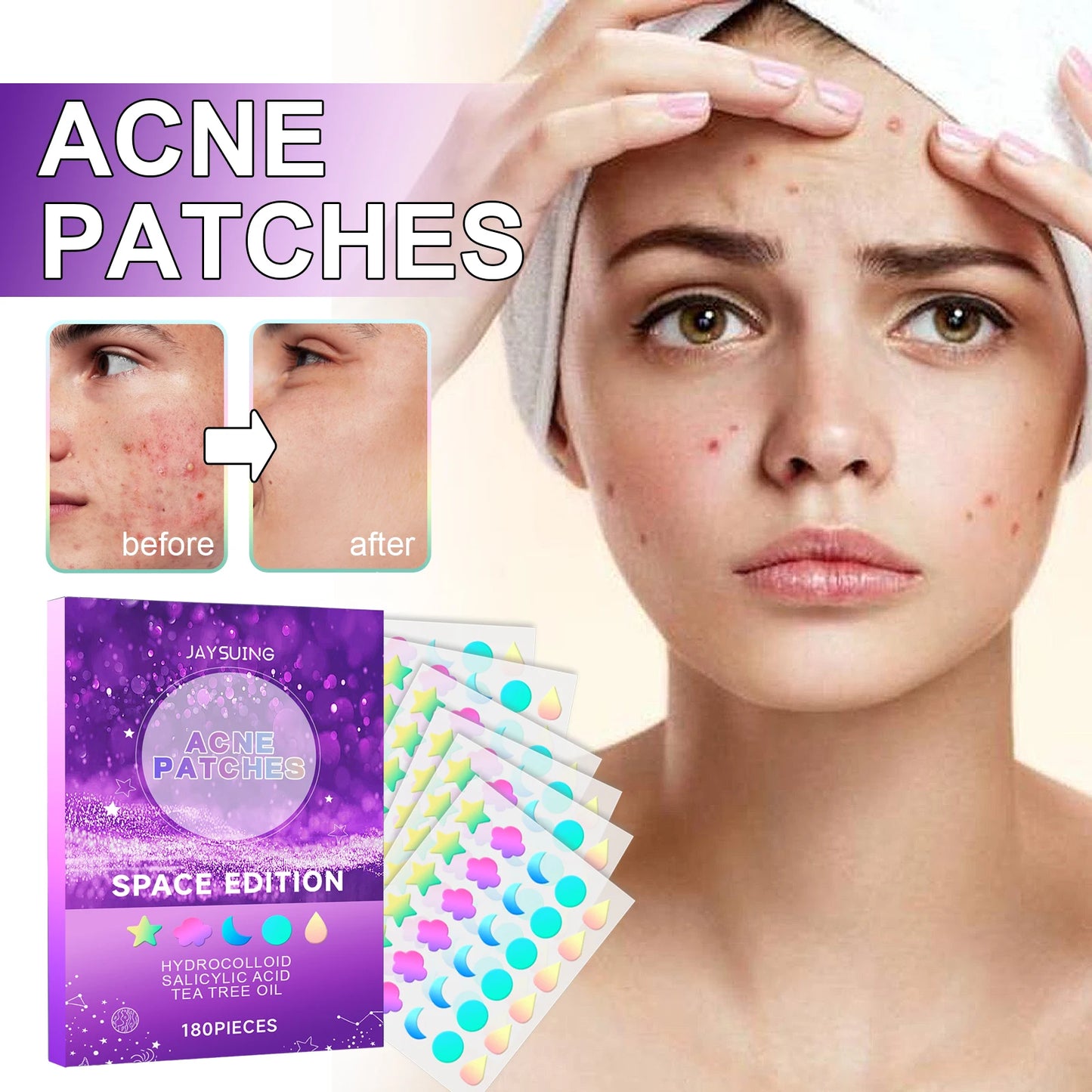 Lightens Body Facial Acne & Pimples Closing Repair - STG Shopping